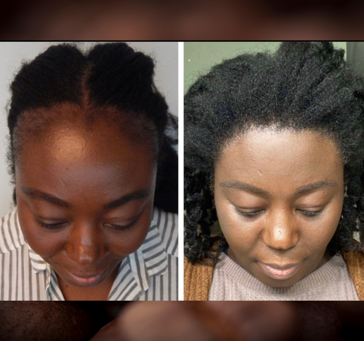 Batana Oil 2oz |Dr.Sebi Approved Hair growth Miracle Oil For Alopecia|