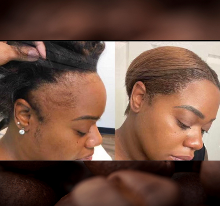 Batana Oil 2oz |Dr.Sebi Approved Hair growth Miracle Oil For Alopecia|