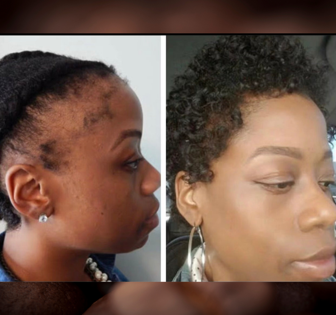 Batana Oil 2oz |Dr.Sebi Approved Hair growth Miracle Oil For Alopecia|