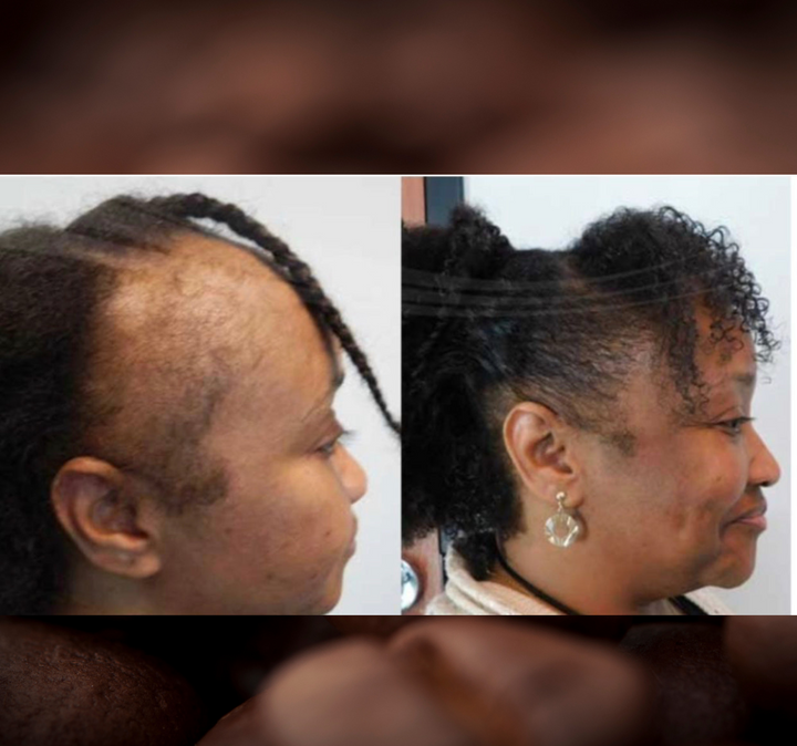 Batana Oil 2oz |Dr.Sebi Approved Hair growth Miracle Oil For Alopecia|